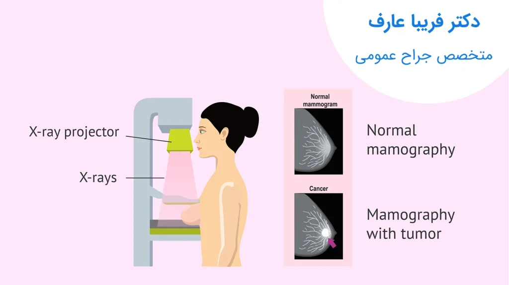 روش‌های معاینه سینه توسط پزشک در مطب